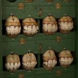 A Mars Globe, a set of paper-mâché horses teeth and a human body model.